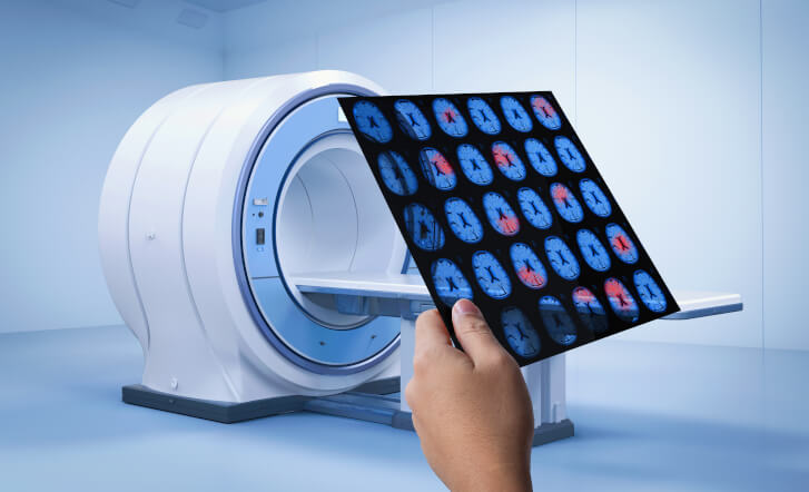 Maszyna do Funkcjonalnego Rezonansu Elektromagnetycznego (fMRI). Ktoś czyta wydruk z wynikami rezonansu